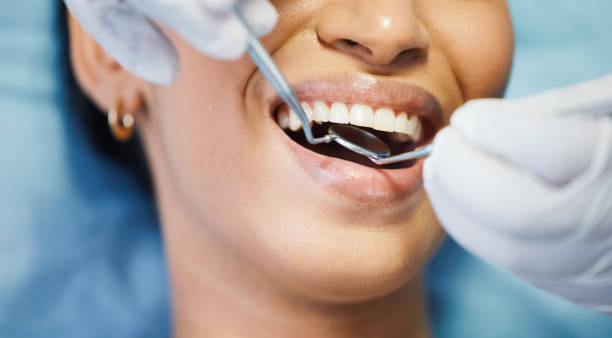 Best Chipped Tooth Repair Near Me  in Narrows, VA