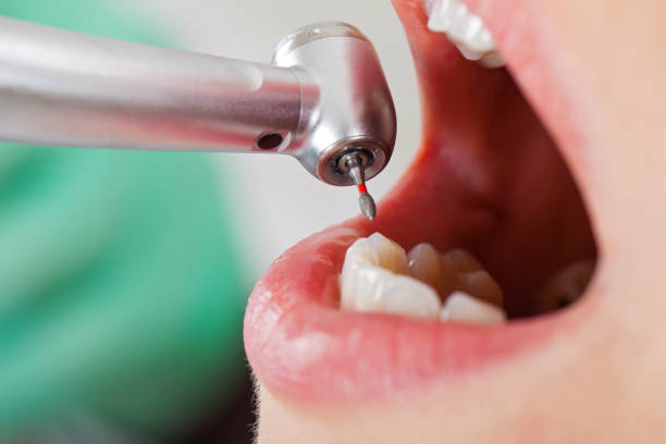 Best Cracked Tooth Emergency Dentist  in Narrows, VA